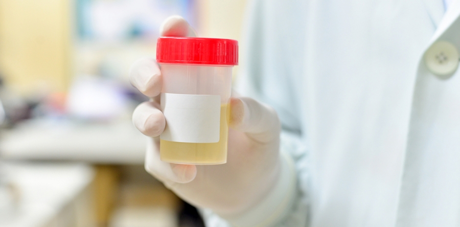Questions to Answer When Choosing your Drug & Alcohol Testing Team